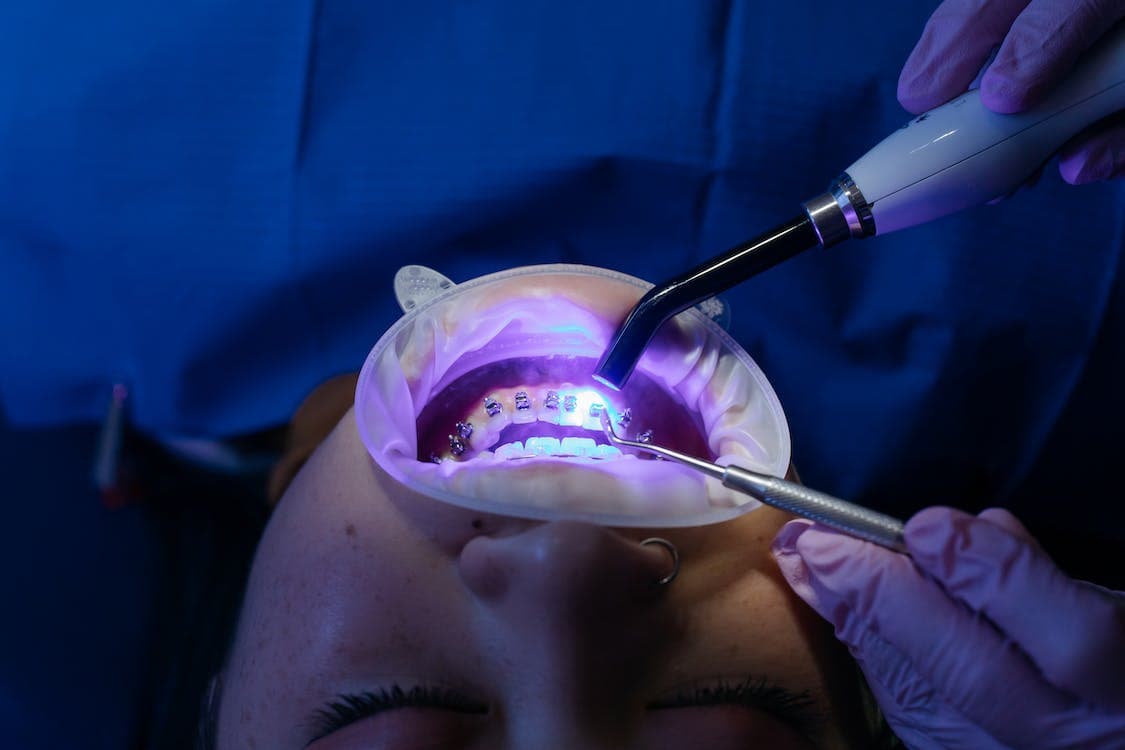 Affordable Braces for Teenagers Hawthorn with Flexible Options