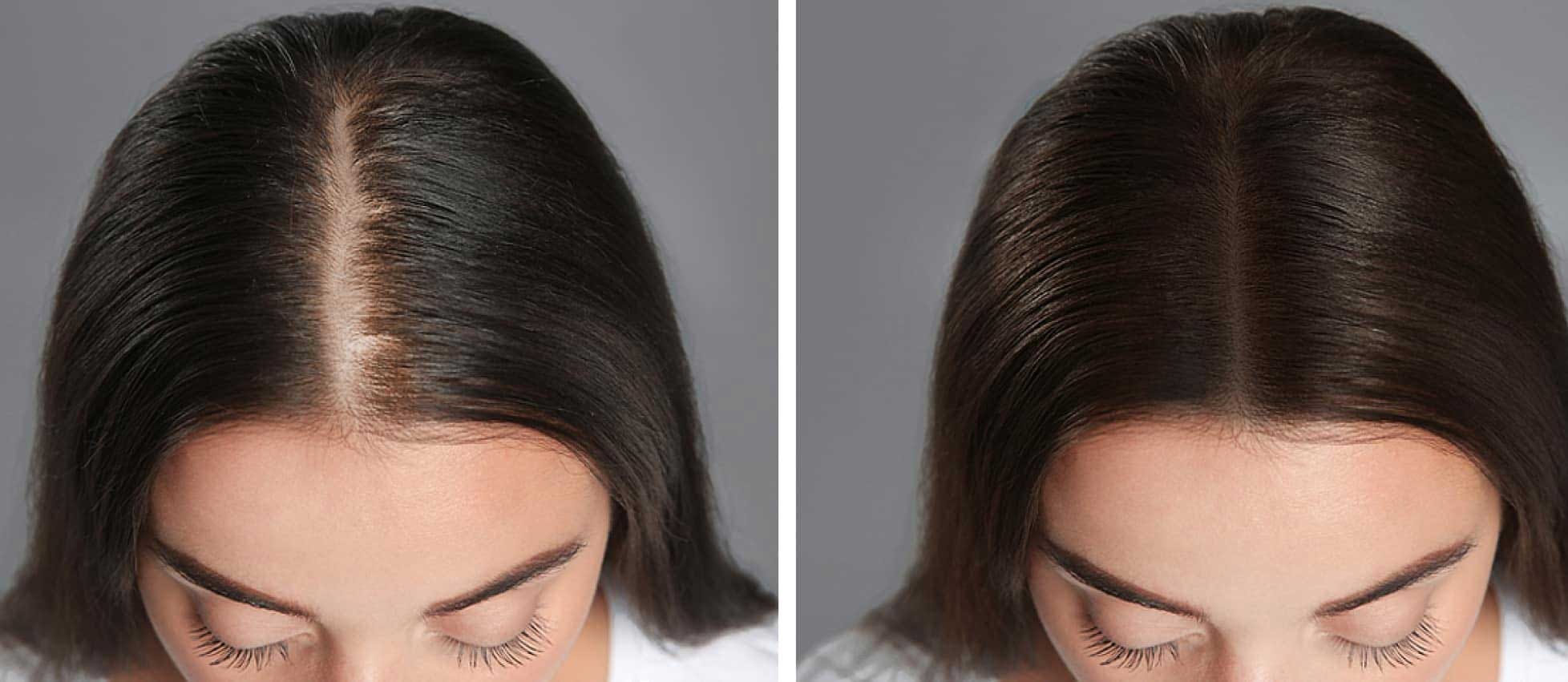 New York Hair Replacement with Precision Styling