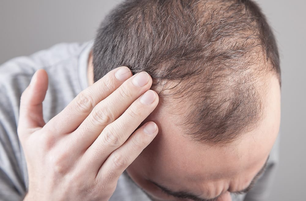 Hair transplant Istanbul with Modern Surgical Methods