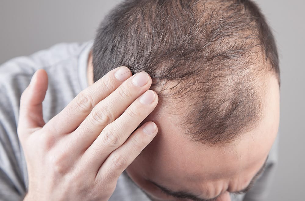 Hair transplant Istanbul with Modern Surgical Methods