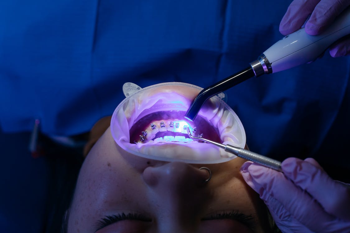 Affordable Braces for Teenagers Hawthorn with Flexible Options